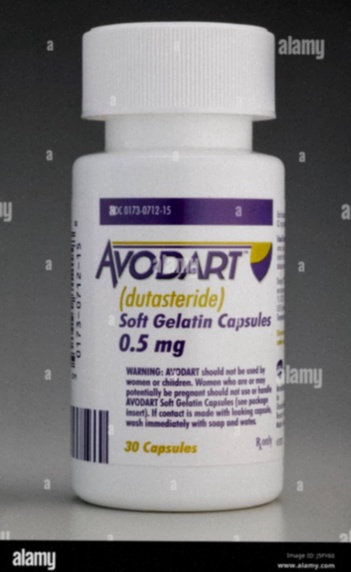 Avodart generico Dutasteride